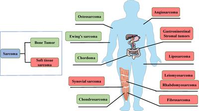 Anlotinib: A Novel Targeted Drug for Bone and Soft Tissue Sarcoma